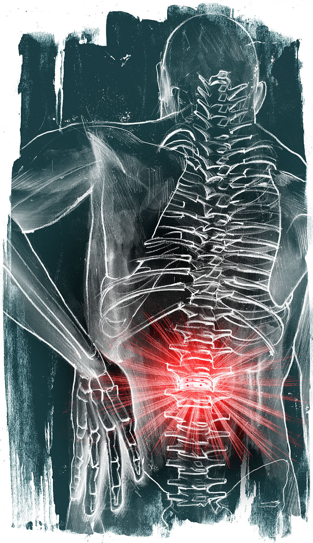 Implantate ruecken illustration - Kornel Illustration | Kornel Stadler portfolio